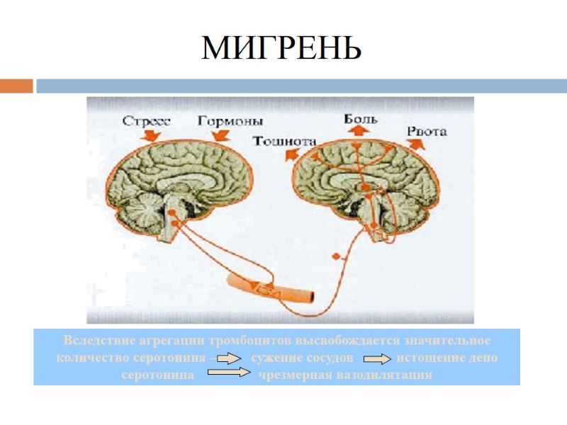МИГРЕНЬ Вследствие агрегации тромбоцитов высвобождается значительное количество серотонина -----     сужение